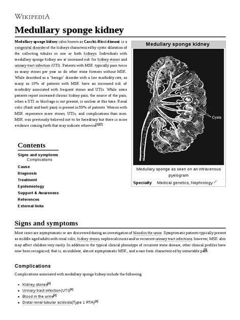 Medullary Sponge Kidney Pdf Medical Specialties Urology