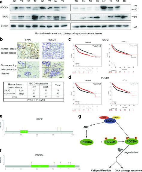 SKP2 And PDCD4 Expression In Human Tissues And Clinical Correlation A