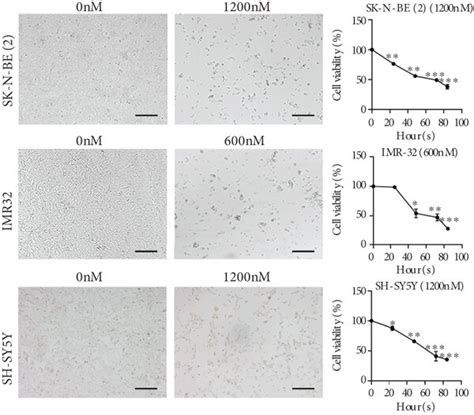 DBET57 Impaired The Proliferation Of NB Cells A NB Cells And 4