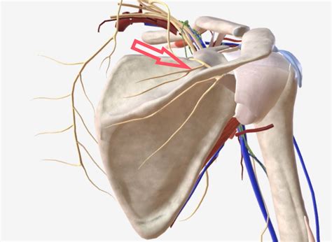 Relieving Shoulder Pain With Suprascapular Nerve Block