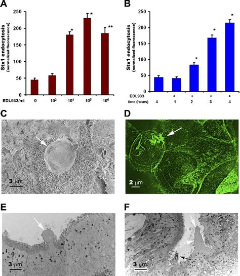 Figure 1 From Enterohemorrhagic Escherichia Coli Infection Stimulates Shiga Toxin 1