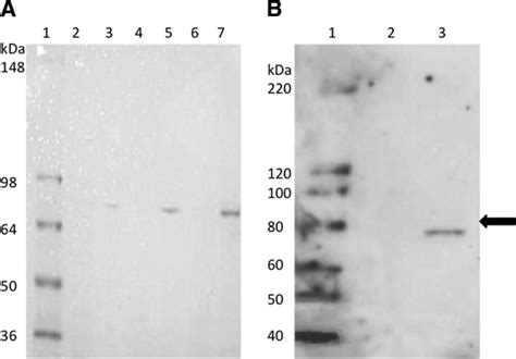 Purification Of The Recombinant Protein Panel A Shows The Coomassie