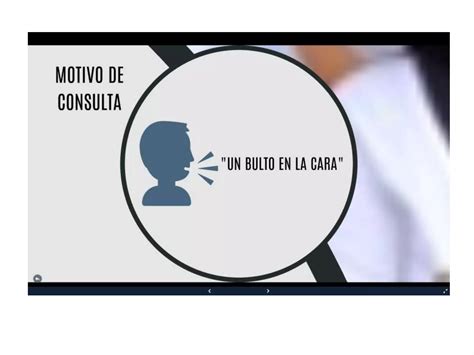 Caso Clinico :Fibroma Osificante | PPTX