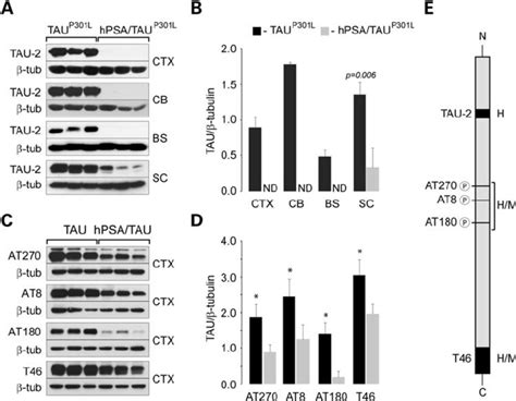 Western Blot Analysis Of 7 Month Old Hpsatau P301l Double Transgenic