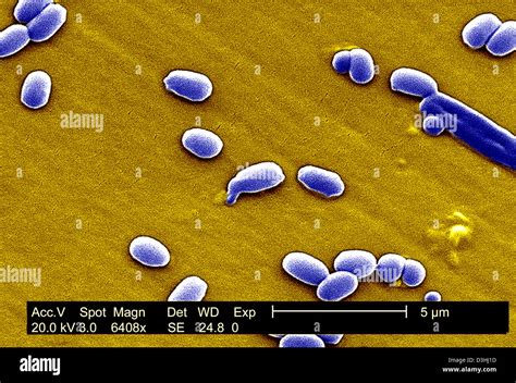 Bacillus Anthracis Micrograph Hi Res Stock Photography And Images Alamy