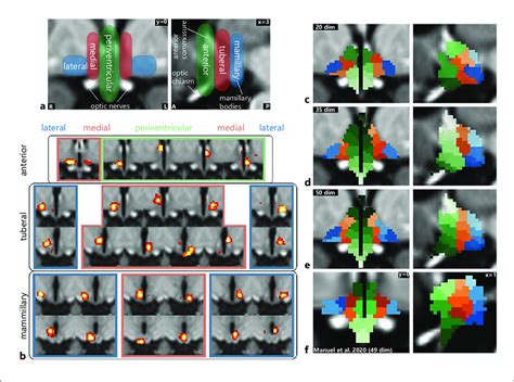 Functional Segmentation Of The Human Hypothalamus A Anatomical