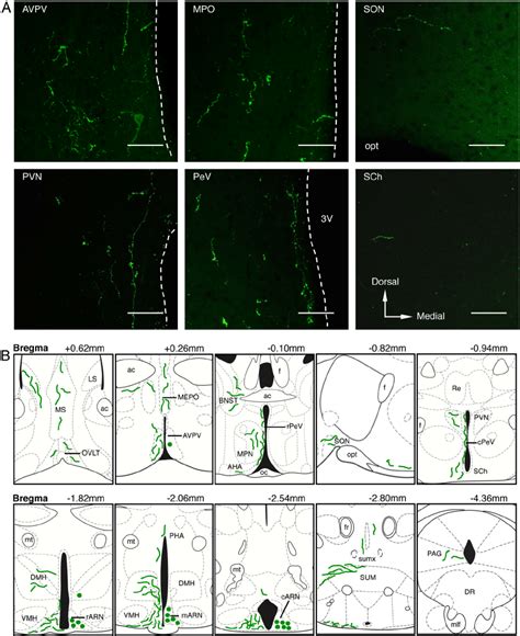 Arn Kisspeptin Fiber Projections A Confocal Images Showing The