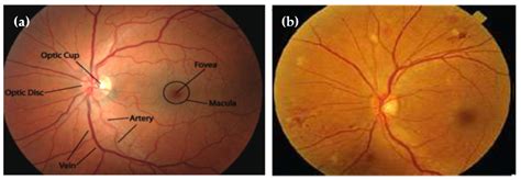 Diagnostics Free Full Text Mobile Hr An Ophthalmologic Based