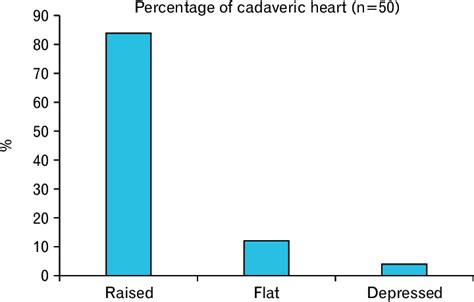 Showing extent and location of Limbus fossa ovalis in the interatrial ...