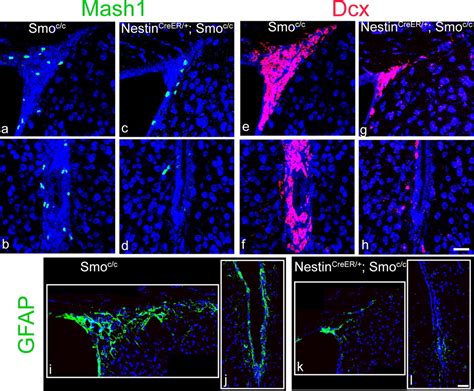 Mosaic Removal Of Hedgehog Signaling In The Adult SVZ Reveals That The