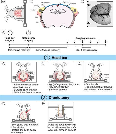 Figure 1 From Cranial Window For Longitudinal And Multimodal Imaging Of