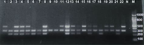 Electrophoresis Of Pcr Products From The Co Amplification Of Gstm