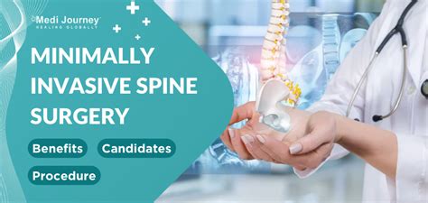 Minimally Invasive Spine Surgery Benefits Candidates And Procedures