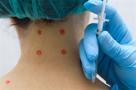 trigger point injection providing pain management pure medical