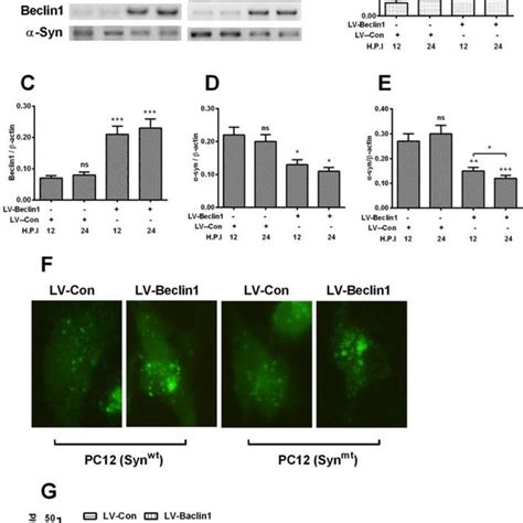 Hmgb1 Upregulation Inhibits α Synuclein Accumulation And Ameliorates