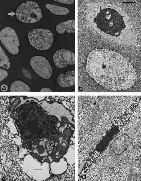 A A Semithin Section Of The Hypertrophic Region Of The Growth Plate