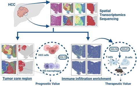 Spatial Maps Of Hepatocellular Carcinoma Transcriptomes Reveal Spatial