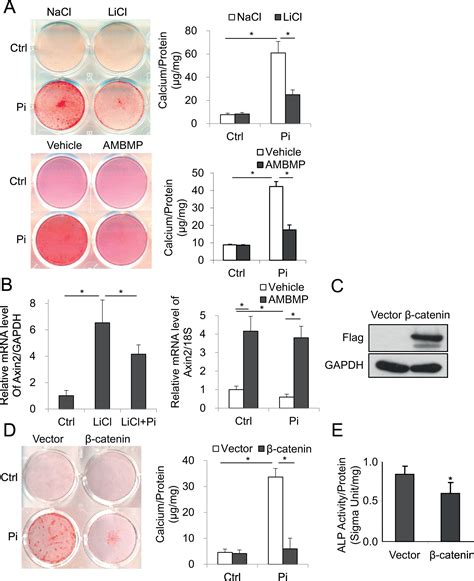 Wnt1 Inhibits Vascular Smooth Muscle Cell Calcification By Promoting