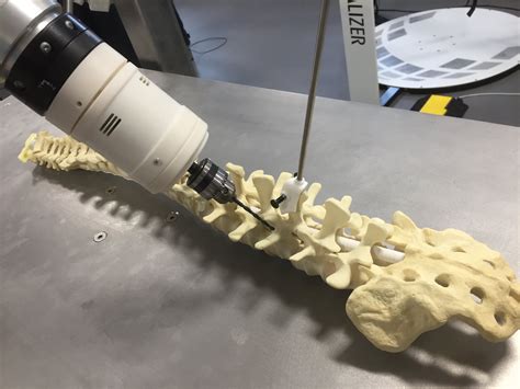 Robots to perform highly accurate spinal surgery in UK