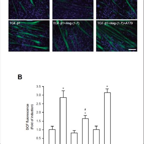 The increase of reactive oxygen species ROS induced by TGF β1 is