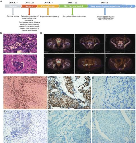 Histologic And Radiographic Findings And Immunohistochemical Staining