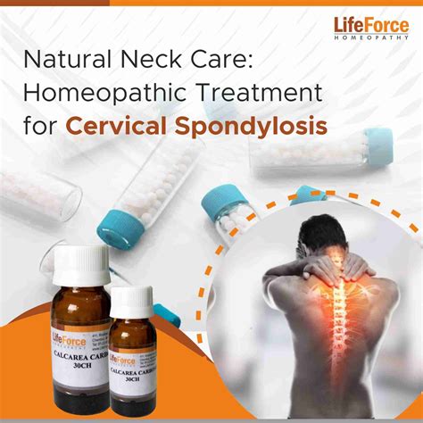 Cervical Spondylosis | Natural Neck Care with Homeopathy