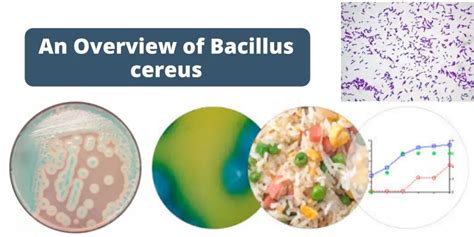 Bacillus cereus - Habitat, Morphology, Pathogenicity, Virulence Factors ...