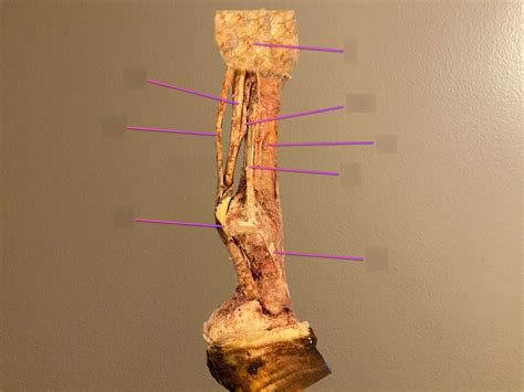 Metacarpus Diagram Quizlet