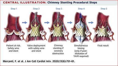 Chimney Stenting For Coronary Occlusion During TAVR Insights From The