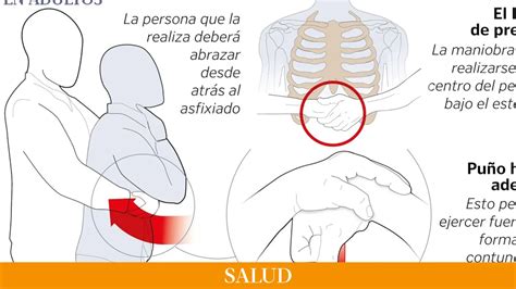 Cómo se hace la maniobra de Heimlich el método que puede salvar una