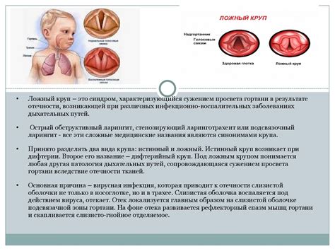 Круп Шипилова - online presentation