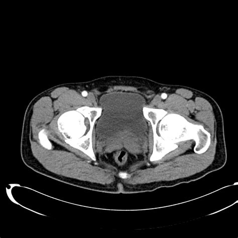 A Systematic Approach to the Interpretation of CT Abdomen/Pelvis