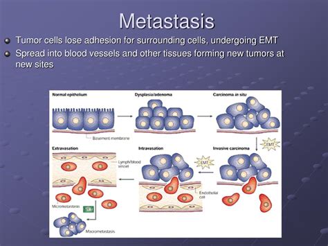 Ppt E Cadherin And Metastasis Powerpoint Presentation Free Download