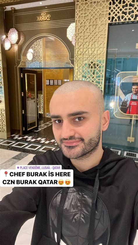 Czn Burak Kanser Mi Aşırı Zayıflaması Korkutmuştu şimdi De Saçlarını