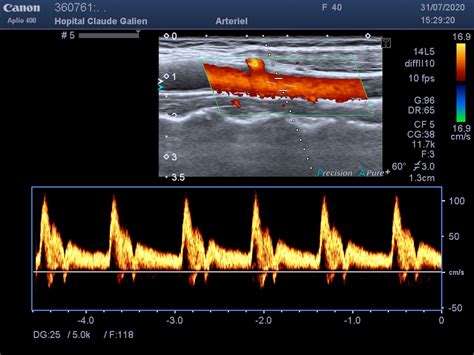 Echographie Et Doppler Hopital Claude Galien