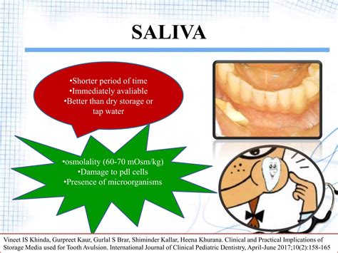 Avulsion | PPT