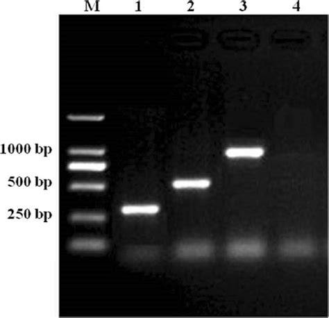 Electrophoresis Of Multiplex PCR Products In Optimization Conditions