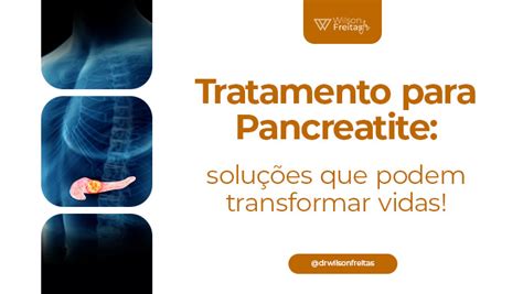 Como Tratar A Pancreatite - Tratamento para pancreatite: soluções que podem transformar vidas! - Dr ...