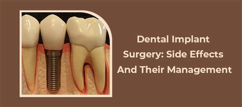 Understanding Dental Implant Surgery Common Side Effects And How To