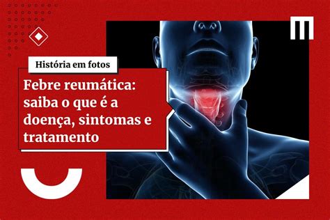 Febre reumática o que é a doença e quais são os sintomas e tratamento