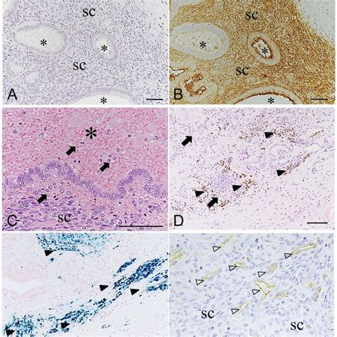 Gross Appearance Of Spontaneous Endometriosis In Cynomolgus Monkey A