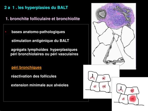 Ppt Le Syst Me Lymphatique Du Parenchyme Pulmonaire Et Sa Pathologie