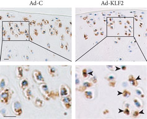 Klf Protects Against Mia Induced Osteoarthritis In Vivo A Schematic