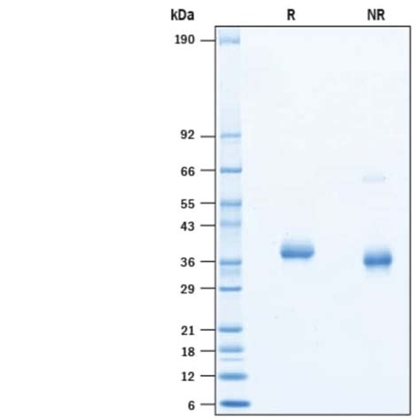 R Recombinant SARS CoV 2 Spike RBD His tag Avi tag Protein CF 50 μg