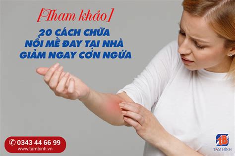 Top 10 Cách Trị Bệnh Mề đay Hiệu Quả Tại Nhà An Toàn Và Hiệu Quả