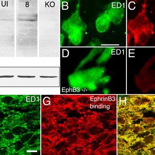 Expression Of EphB3 By Macrophages A In Situ Hybridization Detection