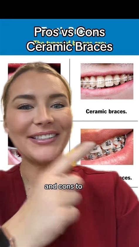 Ceramic Brackets Braces Invisalign Ceramicbraces Lingualbraces