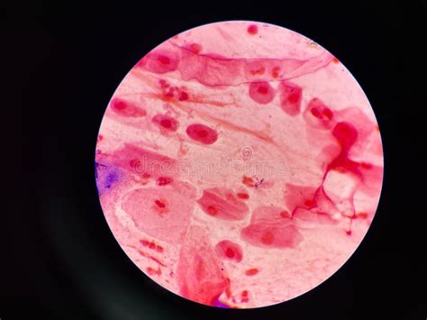 Bacteria Cell in Sputum Sample Gram Stain Method Stock Image - Image of ...