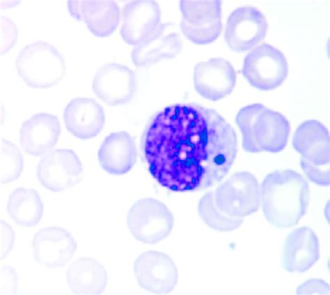 Ehrlichia Canis O Que É - Light micrograph of Ehrlichia canis, Jaboticabal strain, inside a ...