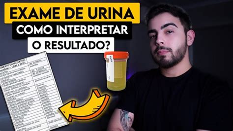 Interpretando Os Resultados Dos Exames De Urina Actualizado Enero 2025